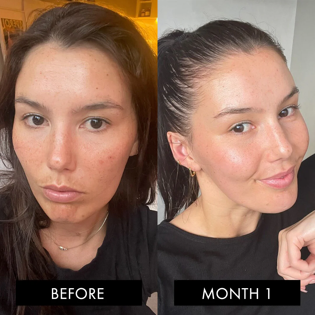 The Collagen Elixir Three Month Pack - Image 5